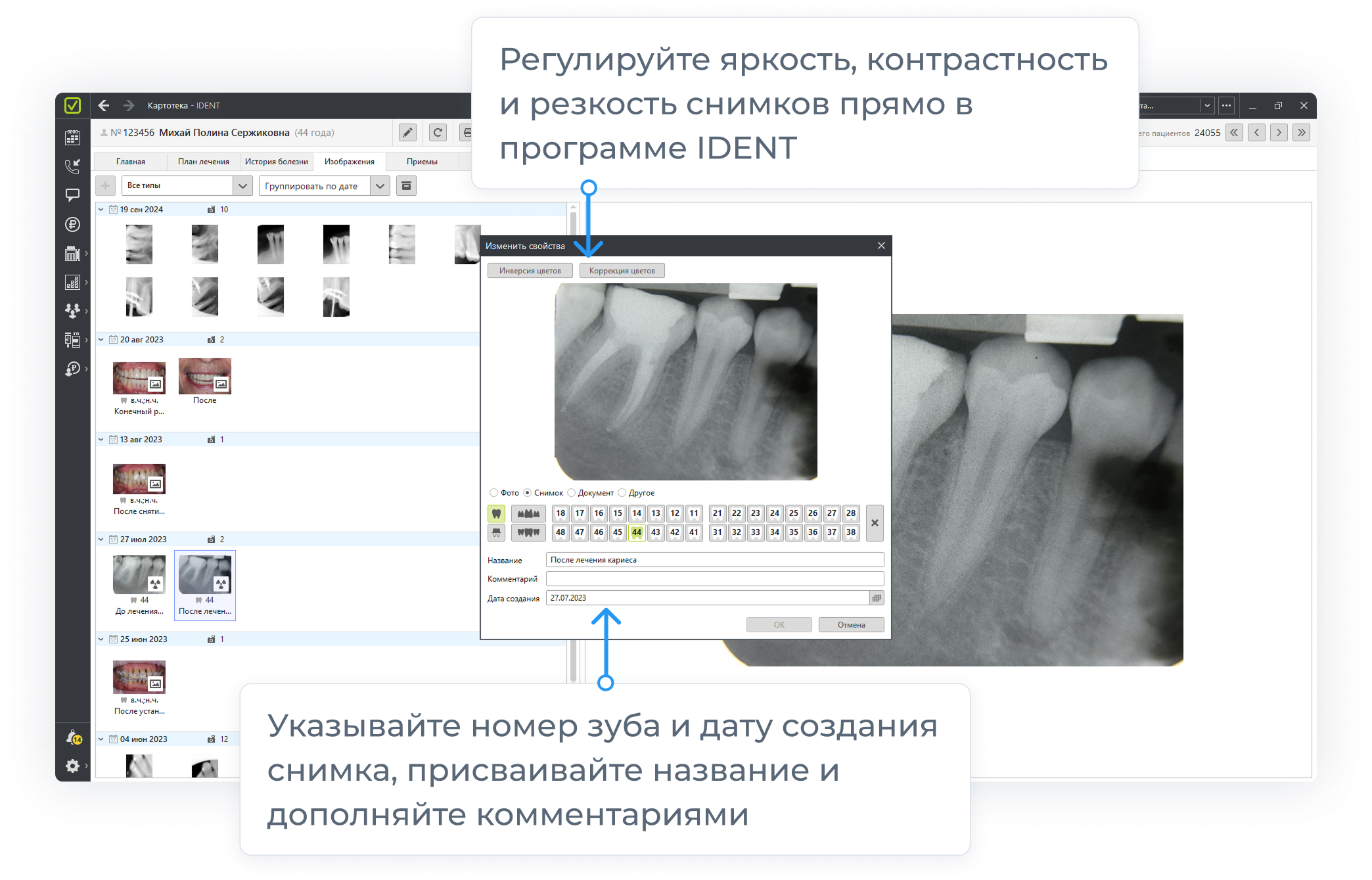 Функция Ident Авторентген - Модуль поможет в работе с рентгеновскими снимками